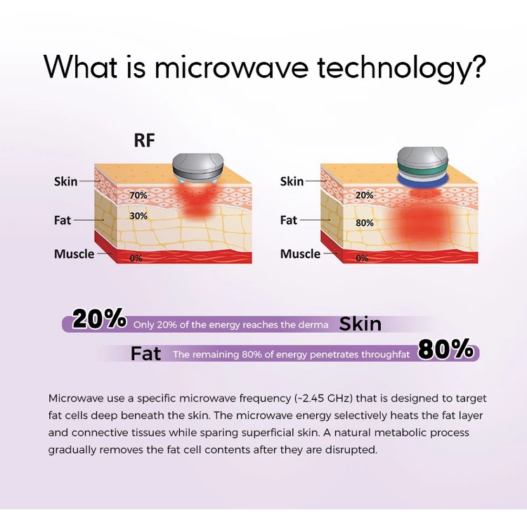 Microwave Fat Reduction Machine for Abdomen Microwave Fat Reduction Machine for Abdomen